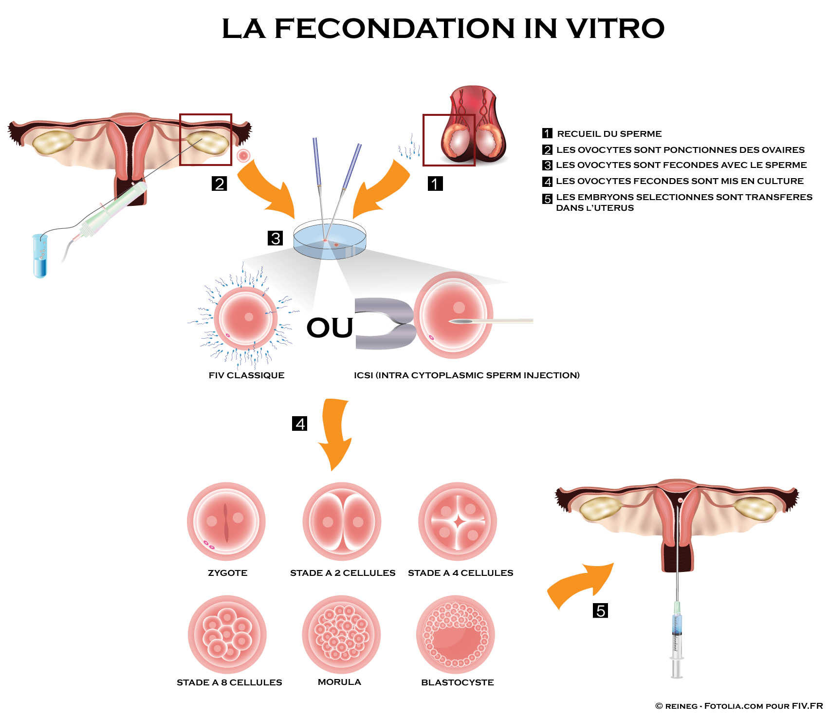 https://i1.wp.com/www.fiv.fr/media/schema-fecondation-in-vitro2.png